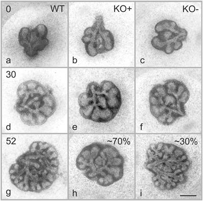 The Development of Integrin Alpha-8 Deficient Lungs Shows Reduced and Altered Branching and a Correction of the Phenotype During Alveolarization